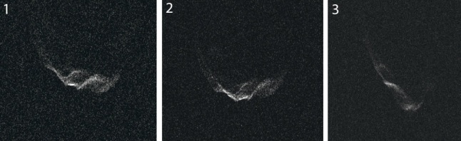 Gambar 3. Tiga sekuens wajah inti komet 209 P/LINEAR seperti diabadikan oleh Teleskop Radio Arecibo dengan gelombang radar dari sudut pandang yang berbeda-beda seiring rotasinya. Nampak tonjolan-tonjolan membukit dengan lembah-lembah cekungan (kawah) diantaranya, yang kemungkinan terbentuk akibat benturan komet ini dengan benda langit lain nun jauh di masa purba. Sumber: Arecibo Observatory, 2014. 
